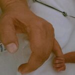 71 273 38443 1497836034 1 1611 PREMATURO