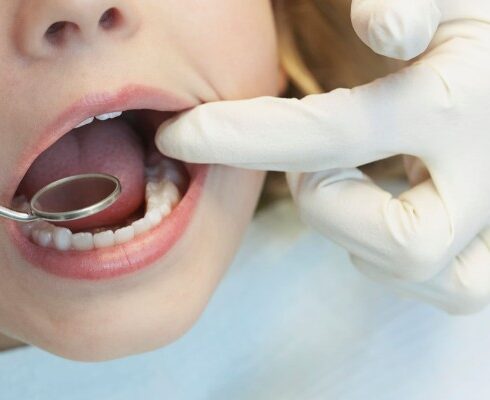 Dentista para niños