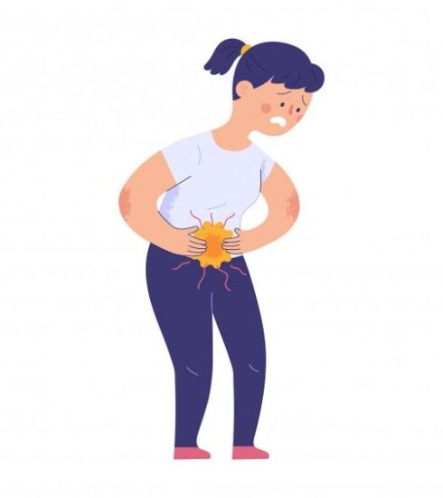 71 273 39663 52684164 2 0314 ENDOMETRIOSIS