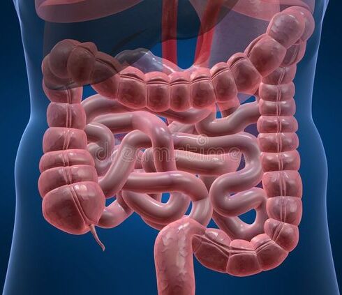 71 273 39917 1262030151 1 0330 CANCER COLON