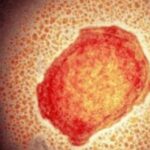 71 273 40538 638886989 1 0516 VIRUELA SIMICA