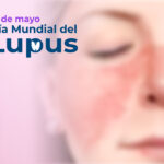 BLOG PRINCIPAL 10 MAYO LUPUS