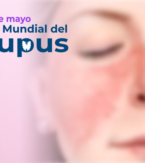BLOG PRINCIPAL 10 MAYO LUPUS