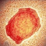 71 273 41638 1339946585 1 SESA 0708 VIRUELA SIMICA