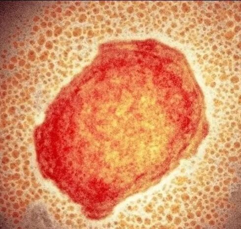 71 273 41638 1339946585 1 SESA 0708 VIRUELA SIMICA