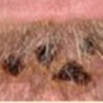 71 273 42217 2017208272 1 SESA 2509 VIRUELA SIMICA