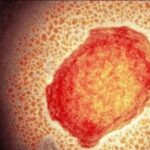 71 273 42370 1160063003 1 SESA 1009 VIRUELA SIMICA