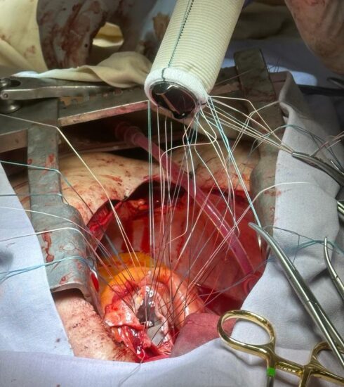 71 273 43207 219762963 3 2112 SESA CIRUGIA CORAZON