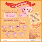 71 273 43938 1982507985 1 1303 sesa endometriosis