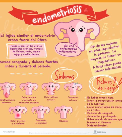 71 273 43938 1982507985 1 1303 SESA ENDOMETRIOSIS