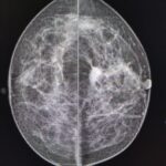 71 273 44056 713627896 IMG