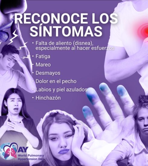 71 273 44236 1021699587 IMG