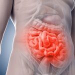 71 273 44310 40918610 2 0805 sesa enfermedad inflamatoria intestinal