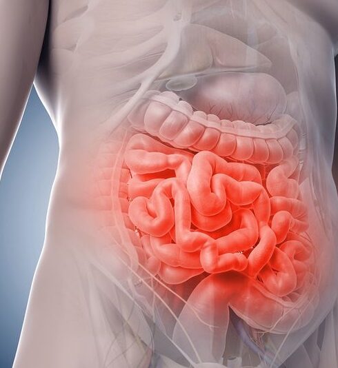 71 273 44310 40918610 2 0805 SESA ENFERMEDAD INFLAMATORIA INTESTINAL