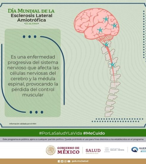 71 273 44594 2028813857 1 2106 SESA ESCLEROSIS LATERAL AMIOTROFICA