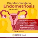 71 273 47320 787856124 1 1403 SESA ENDOMETRIOSIS