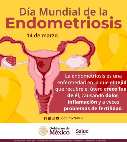 71 273 47320 787856124 1 1403 SESA ENDOMETRIOSIS
