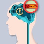 71 273 49601 1224980620 1 2810 sesa ictus